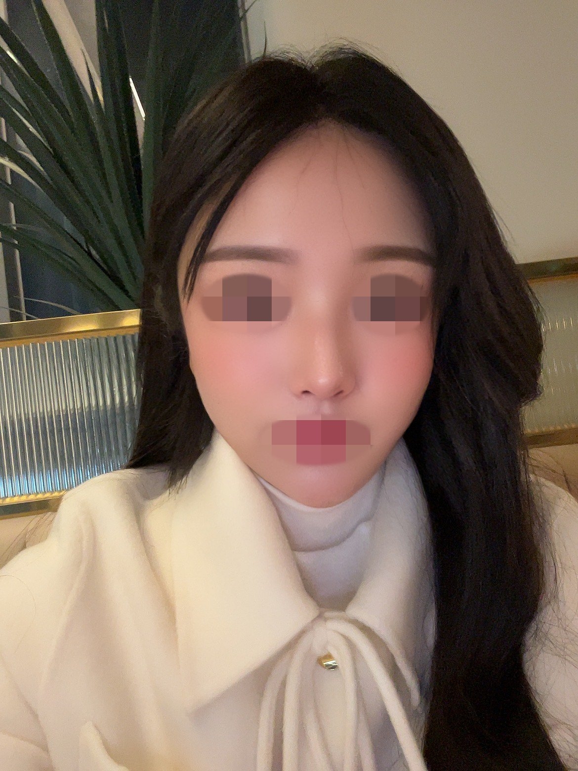 수술후기이미지