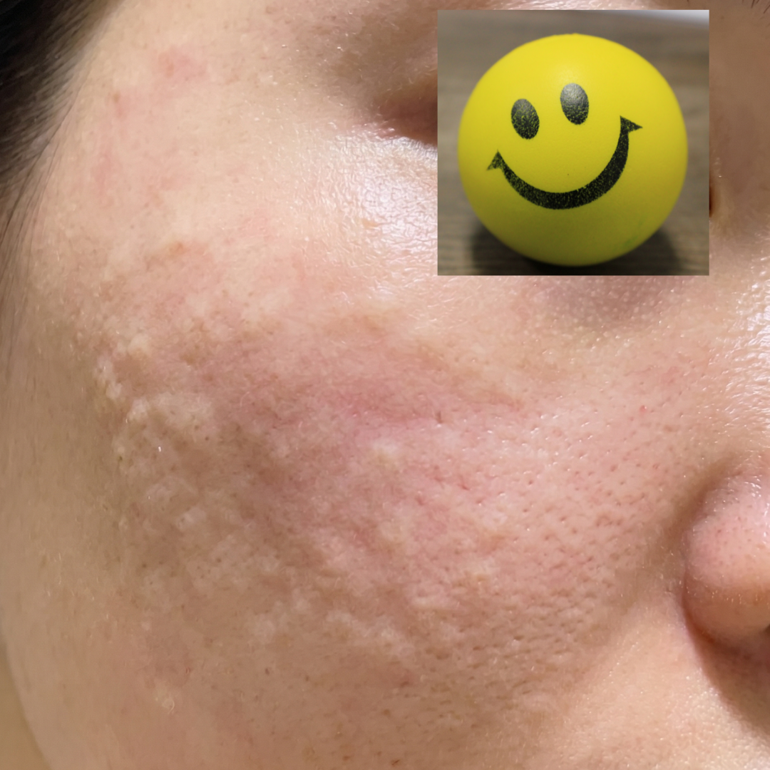 수술후기이미지