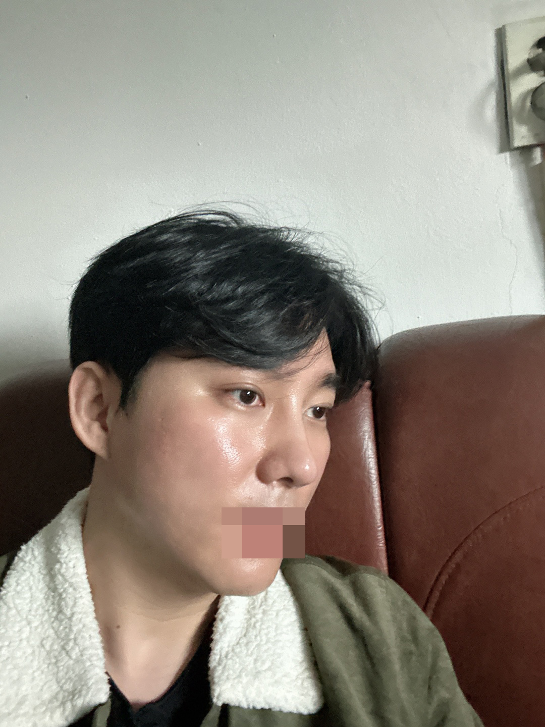 수술후기이미지