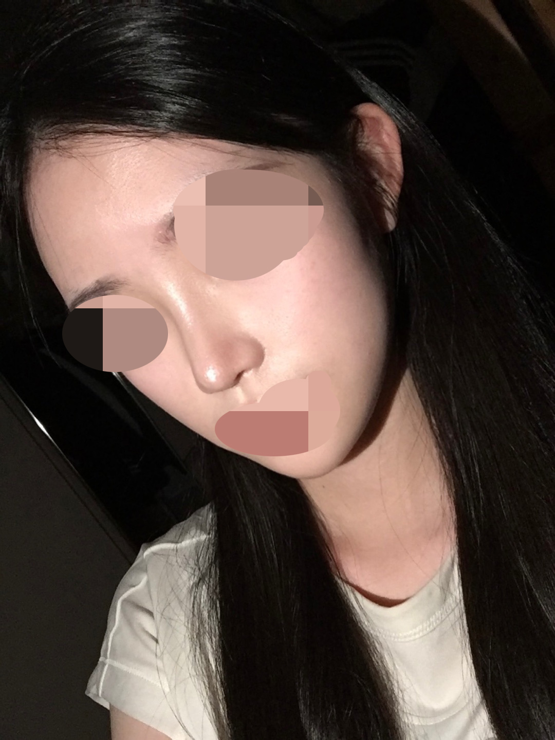 수술후기이미지