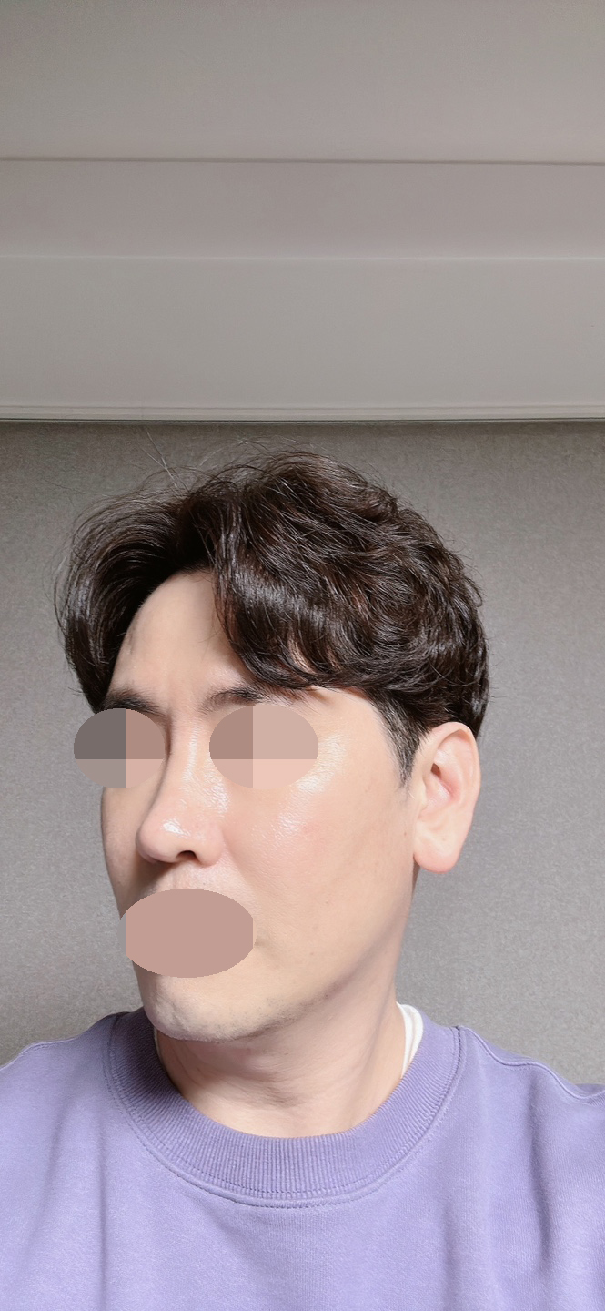 수술후기이미지