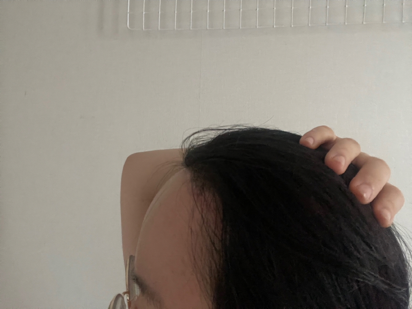 수술후기이미지