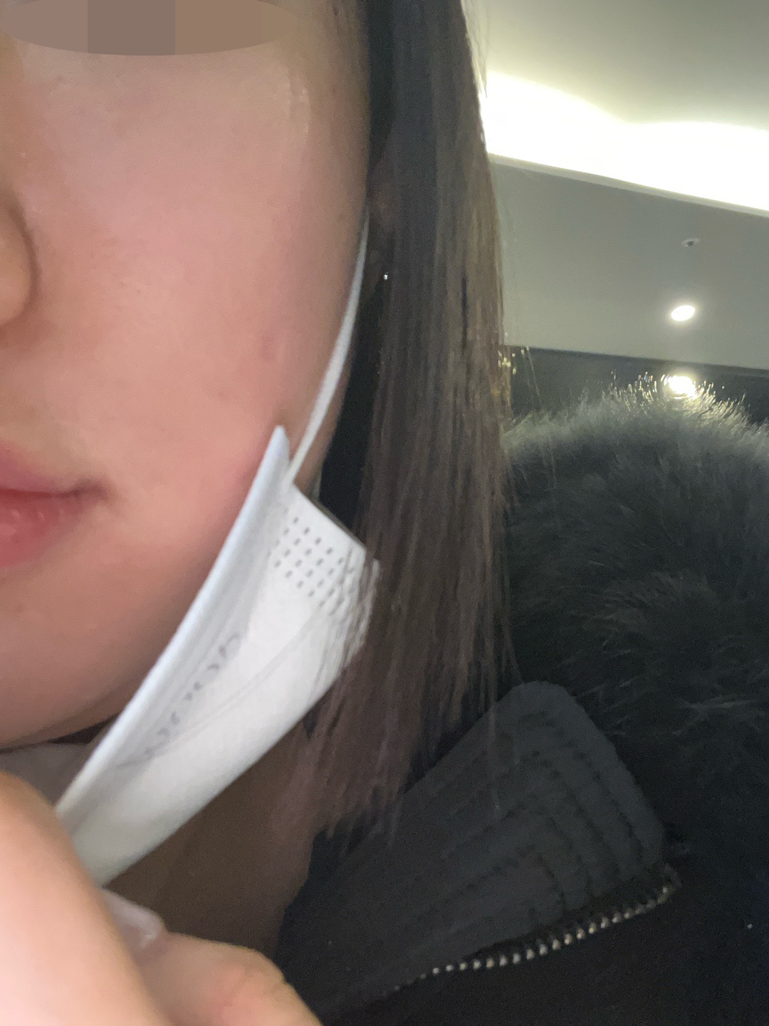 수술후기이미지