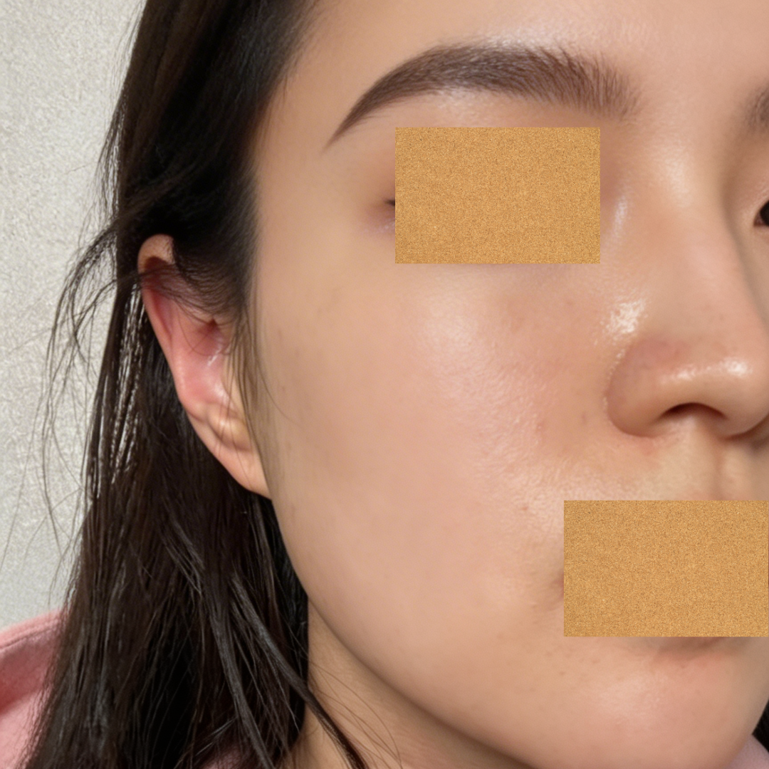 수술후기이미지