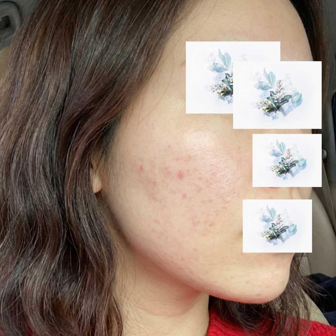 수술후기이미지