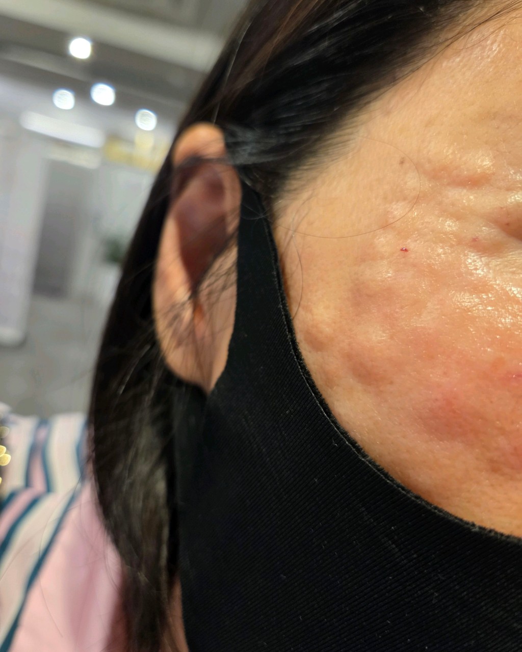 수술후기이미지