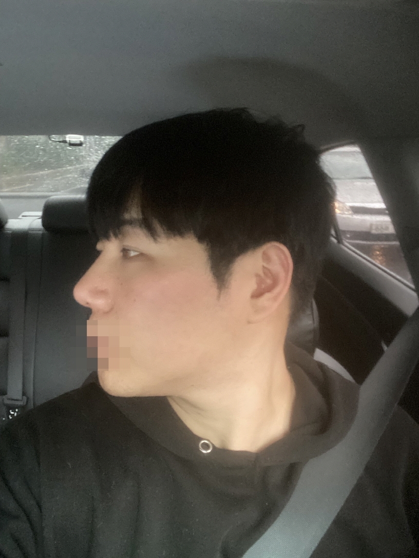 수술후기이미지