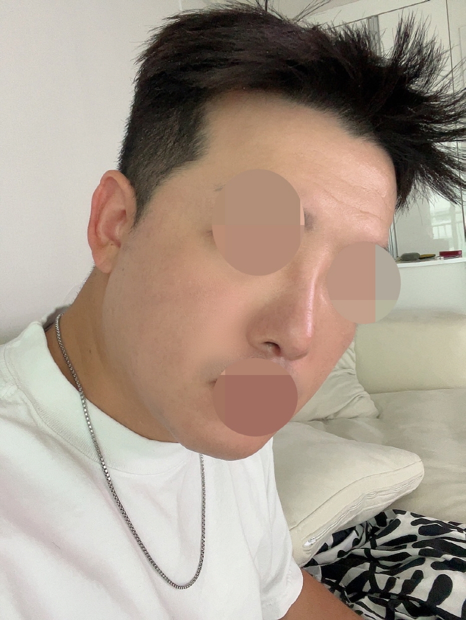 수술후기이미지