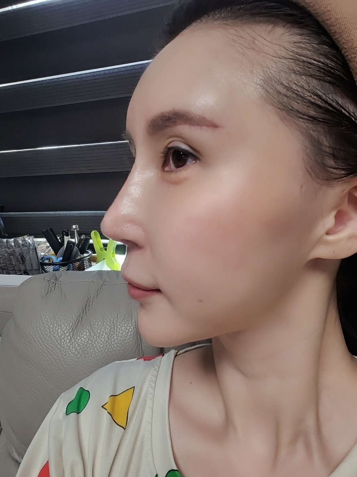 수술후기이미지