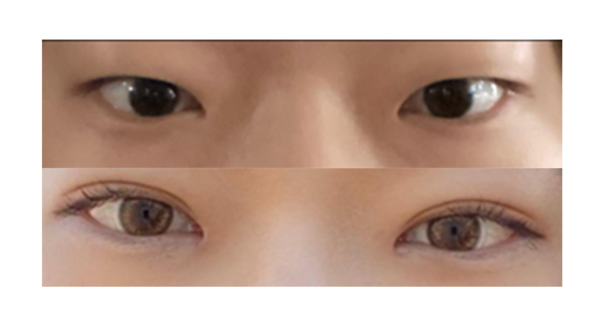 수술후기이미지