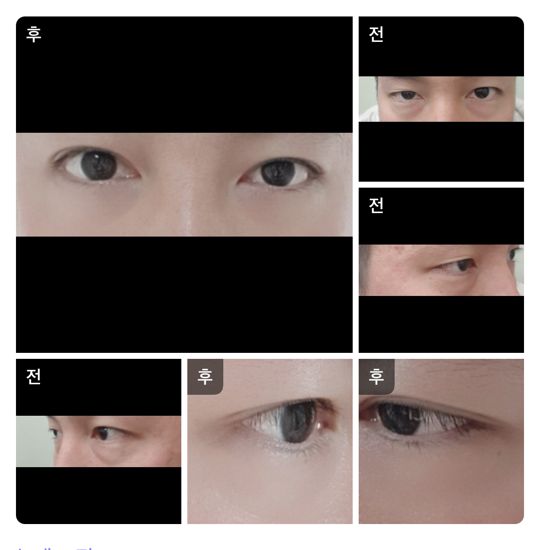 수술후기이미지