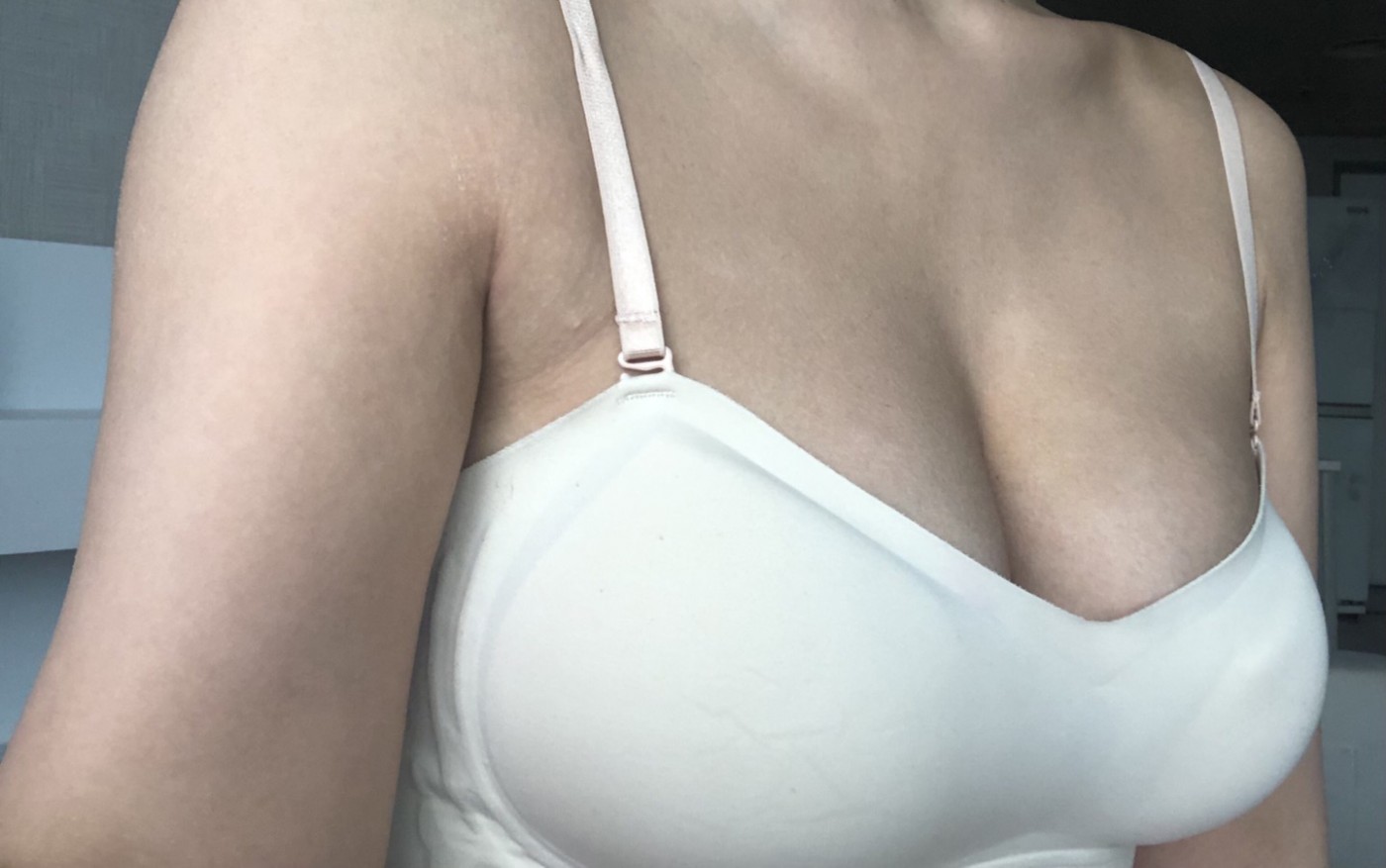 수술후기이미지