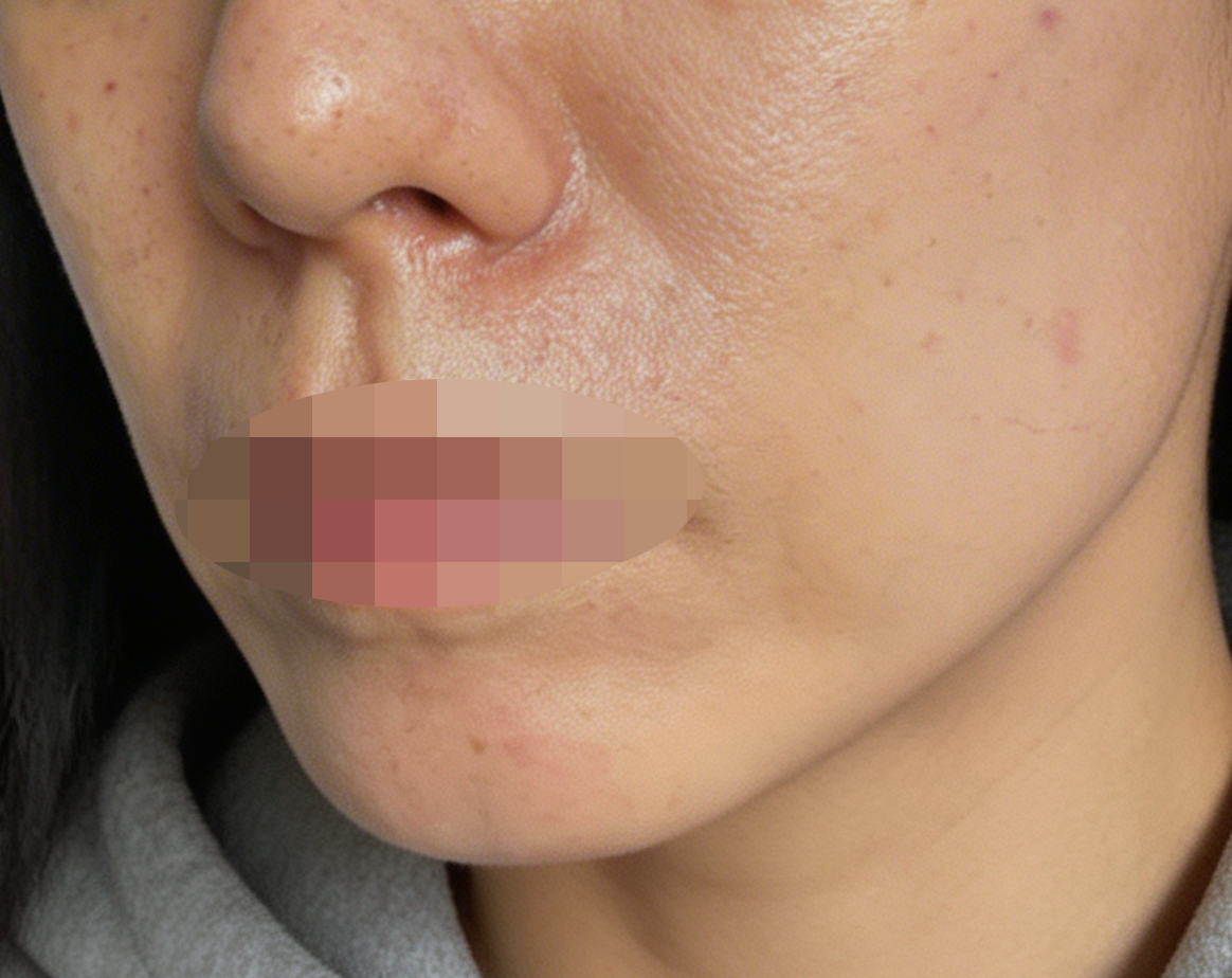 수술후기이미지