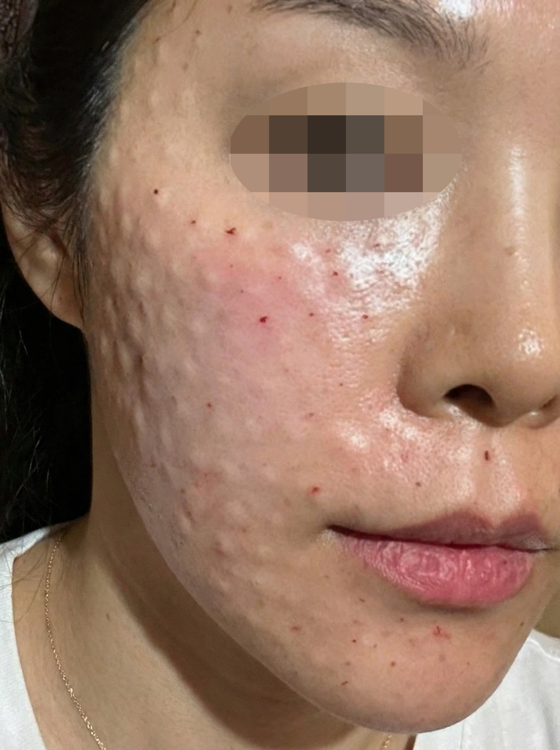 수술후기이미지