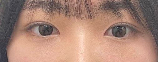 수술후기이미지