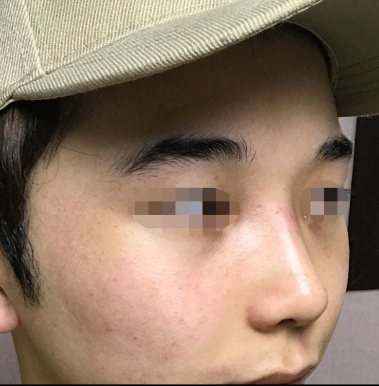 수술후기이미지