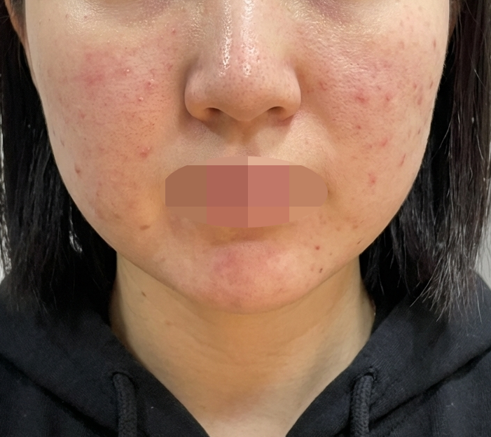 수술후기이미지