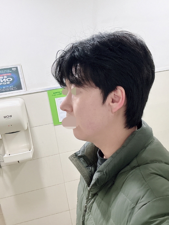 수술후기이미지