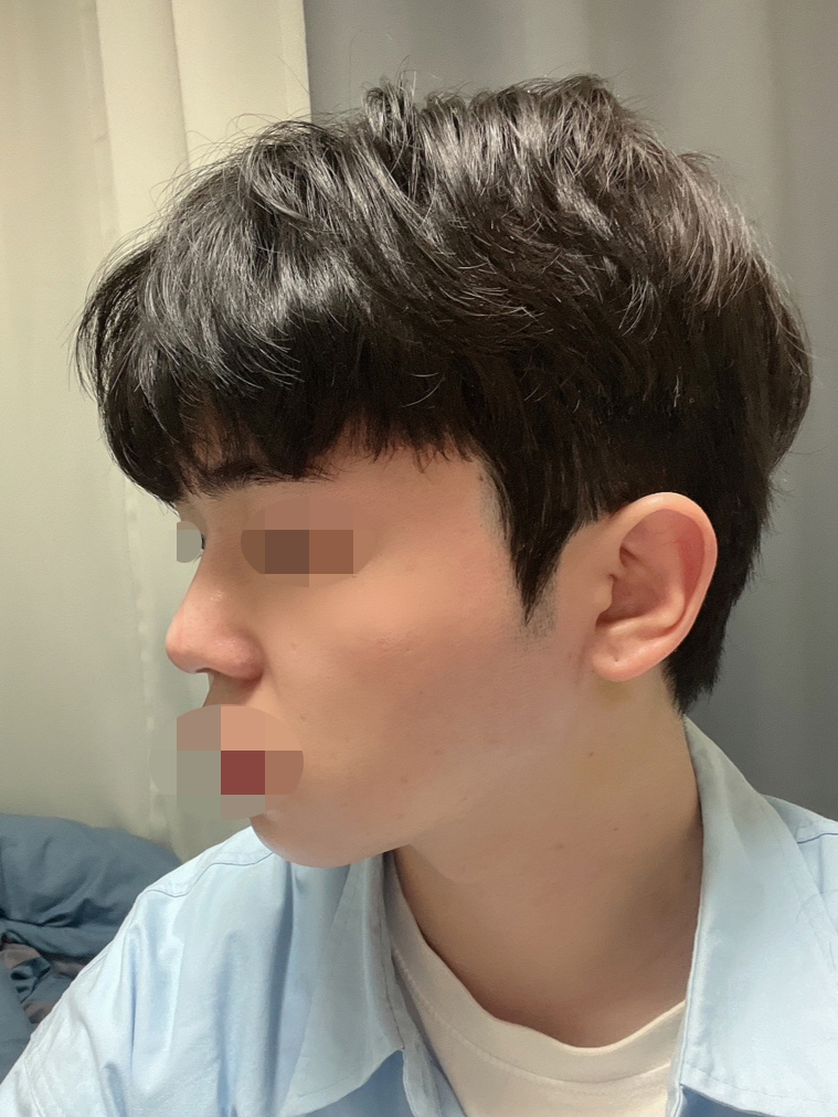 수술후기이미지