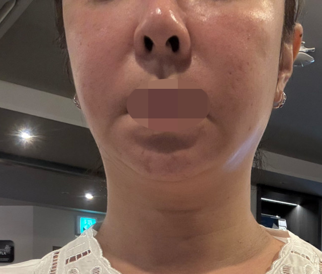 수술후기이미지