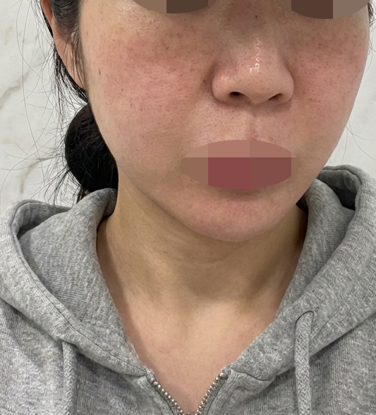 수술후기이미지