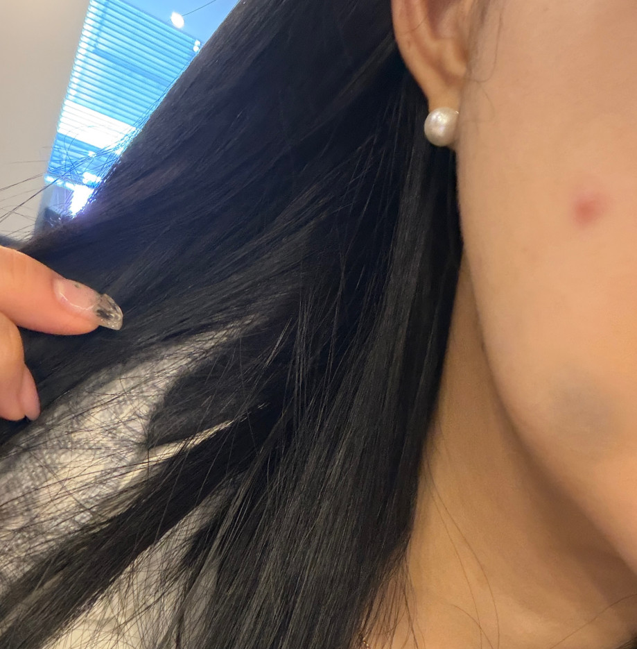 수술후기이미지