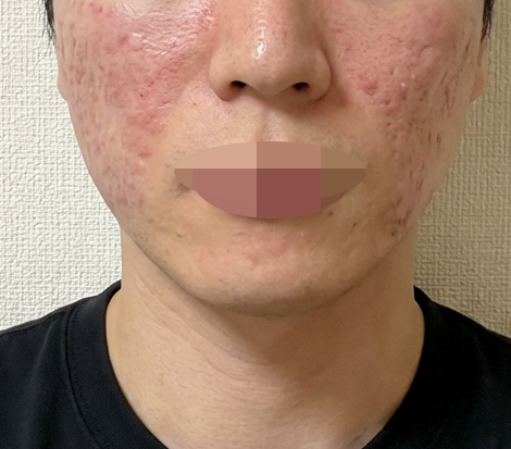 수술후기이미지