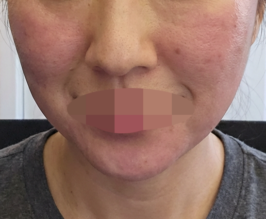 수술후기이미지