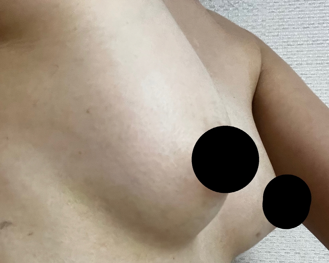 수술후기이미지