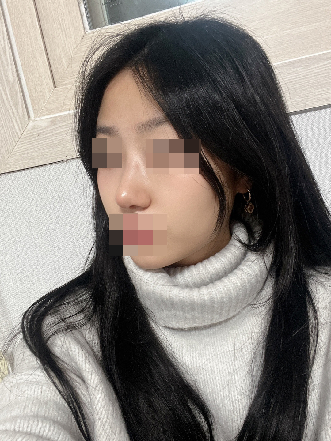 수술후기이미지