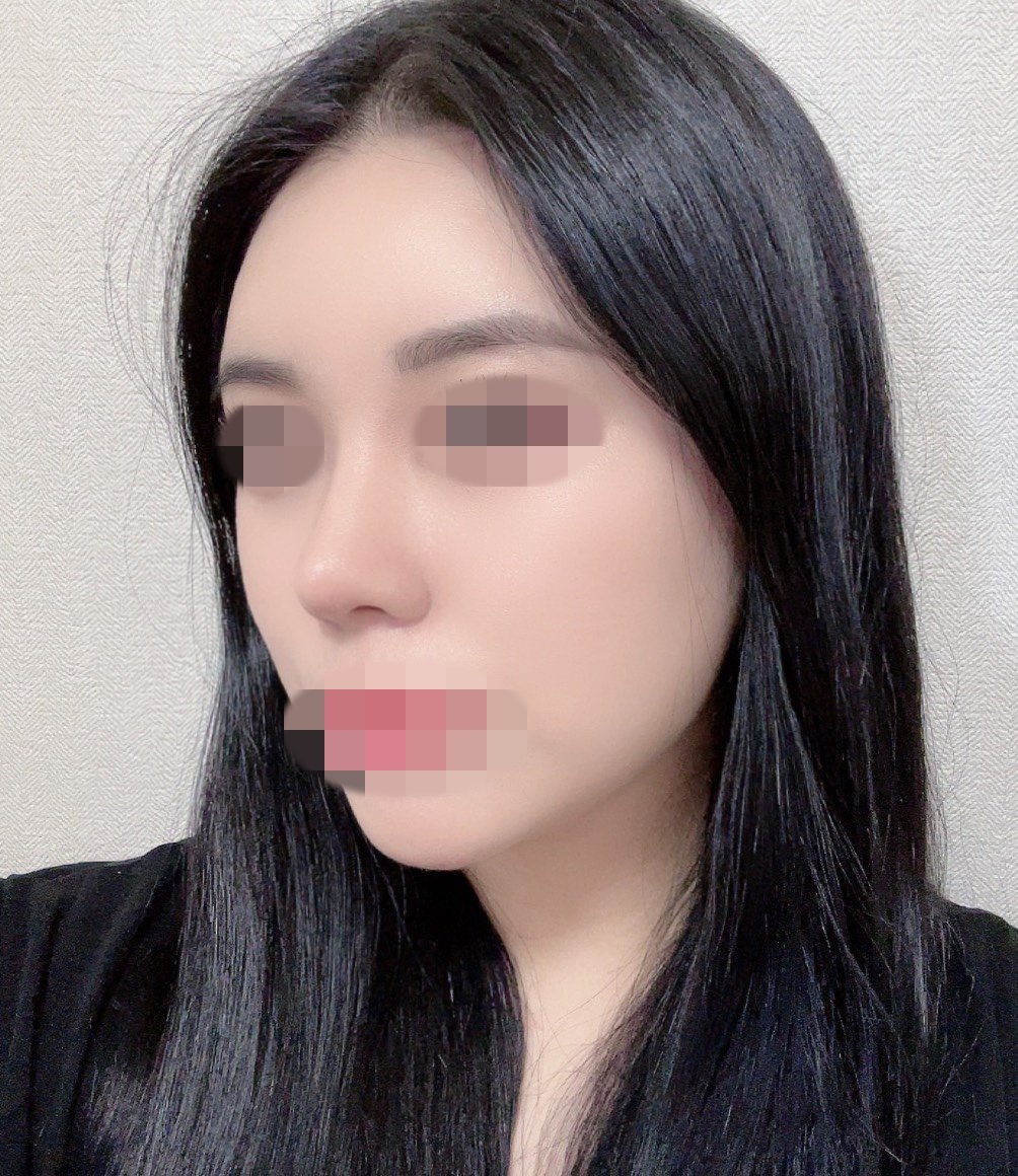 수술후기이미지