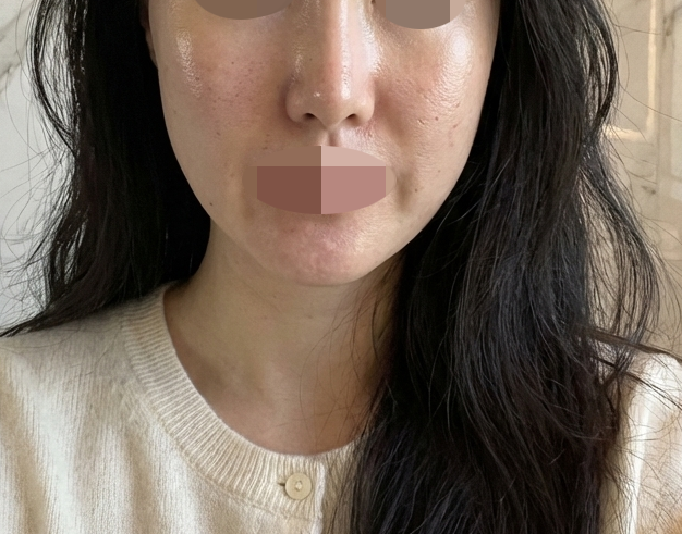 수술후기이미지