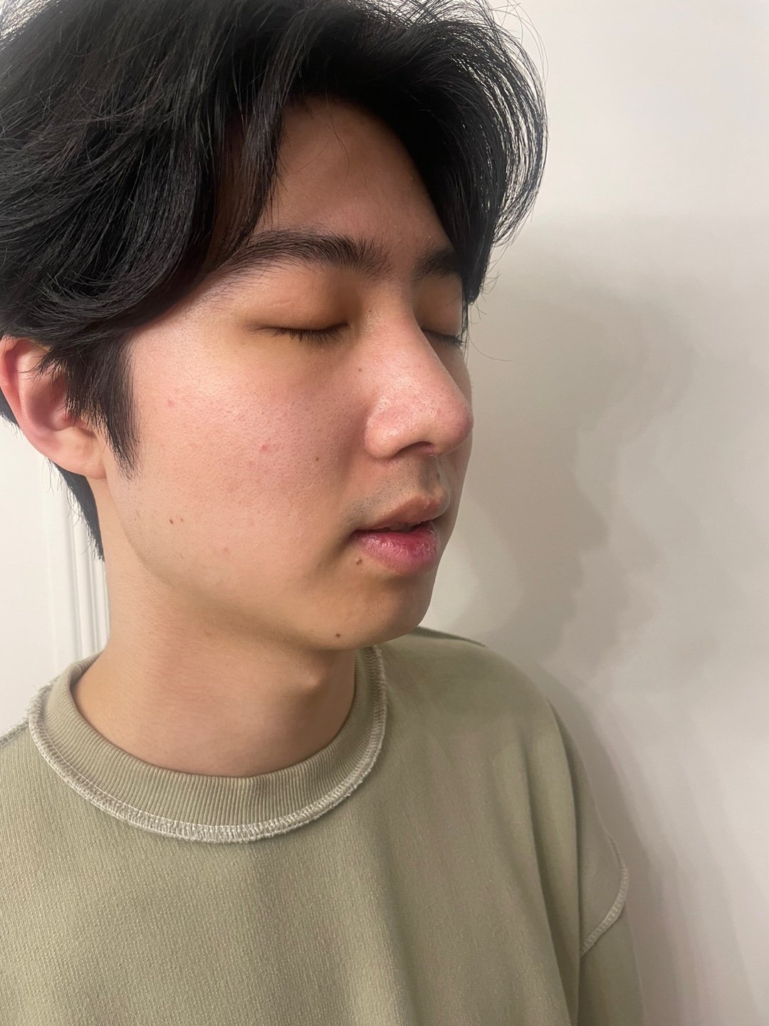 수술후기이미지