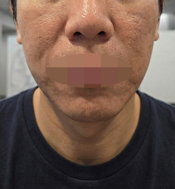 수술후기이미지