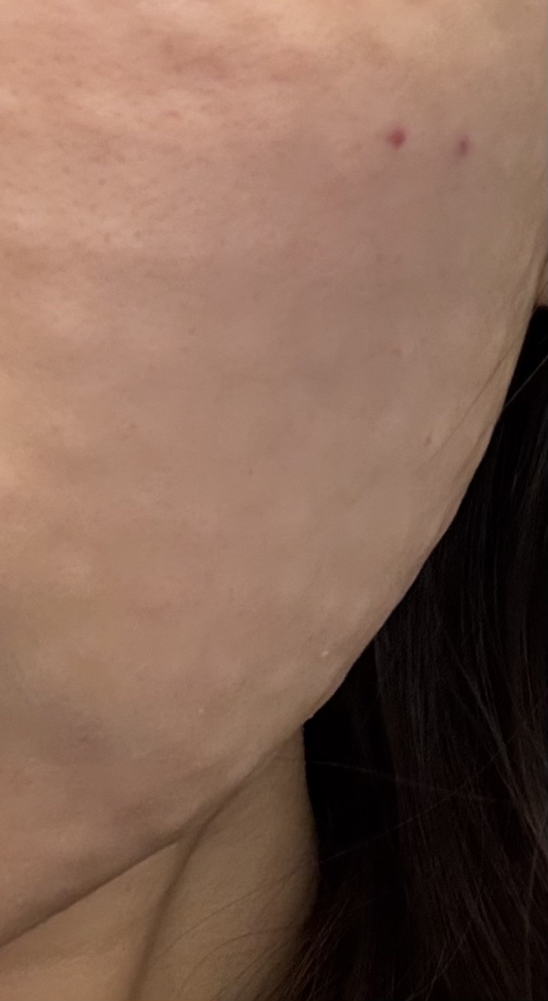 수술후기이미지