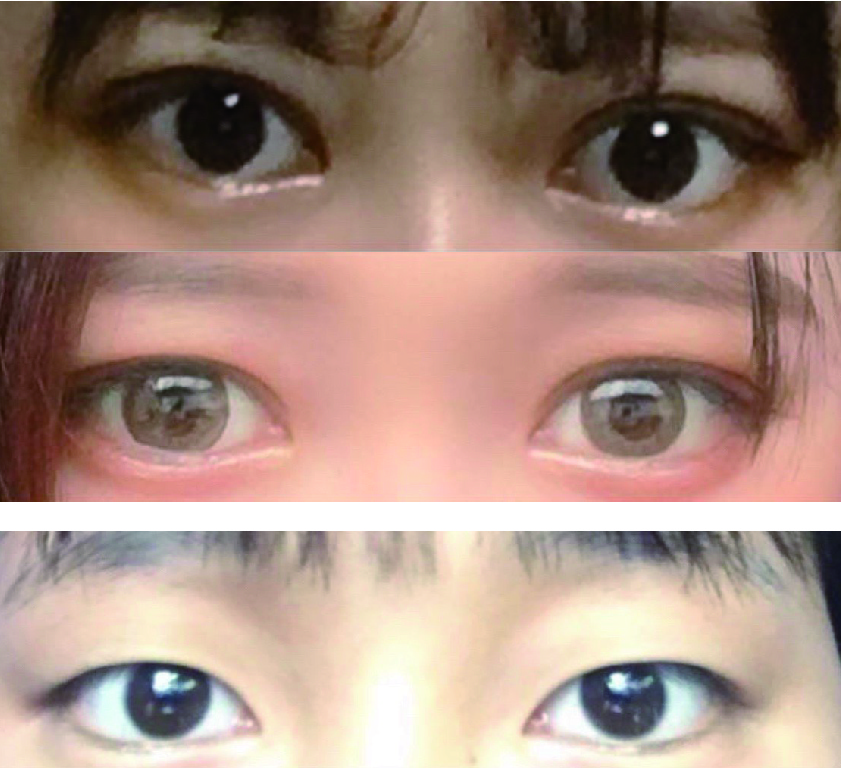 수술후기이미지