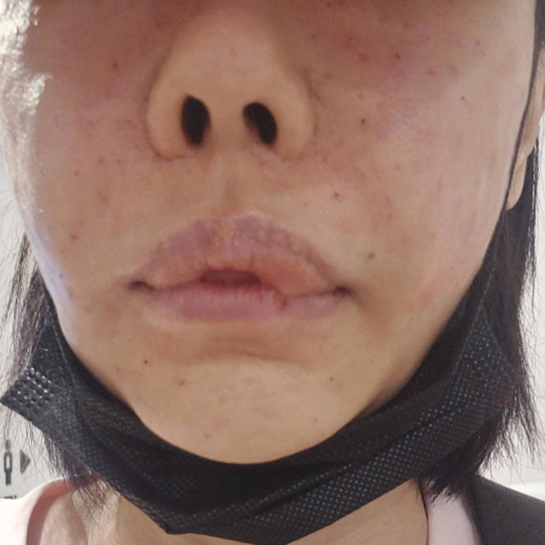 수술후기이미지