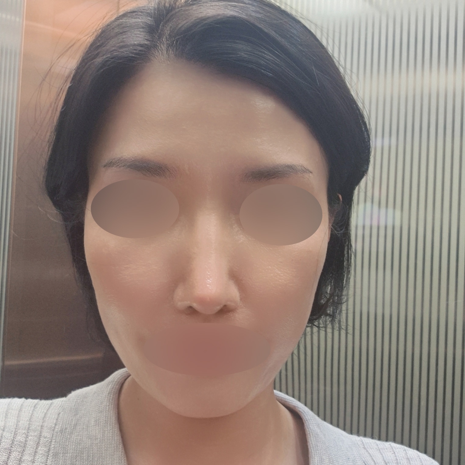 수술후기이미지