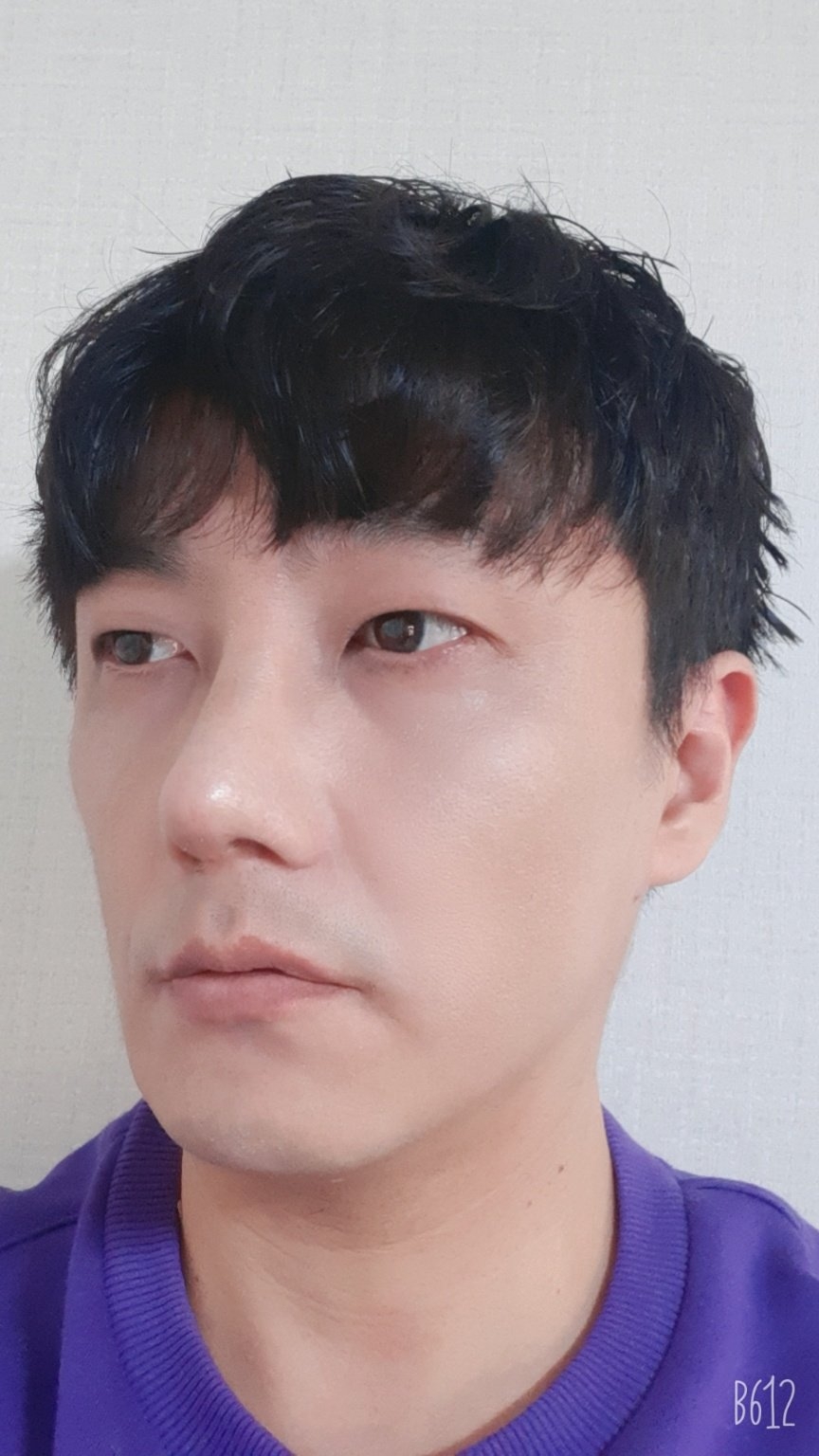 수술후기이미지