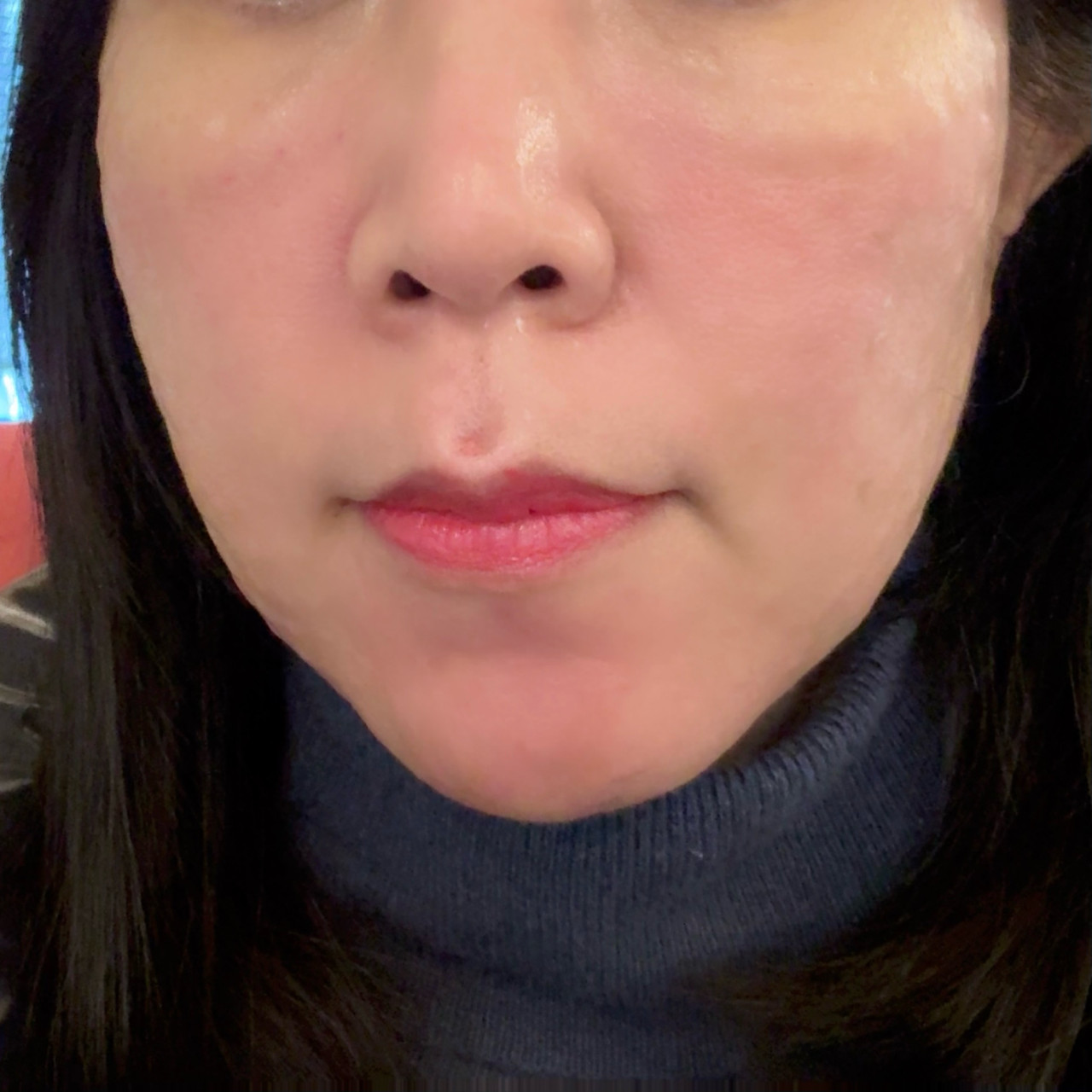 수술후기이미지