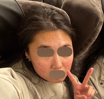 수술후기이미지