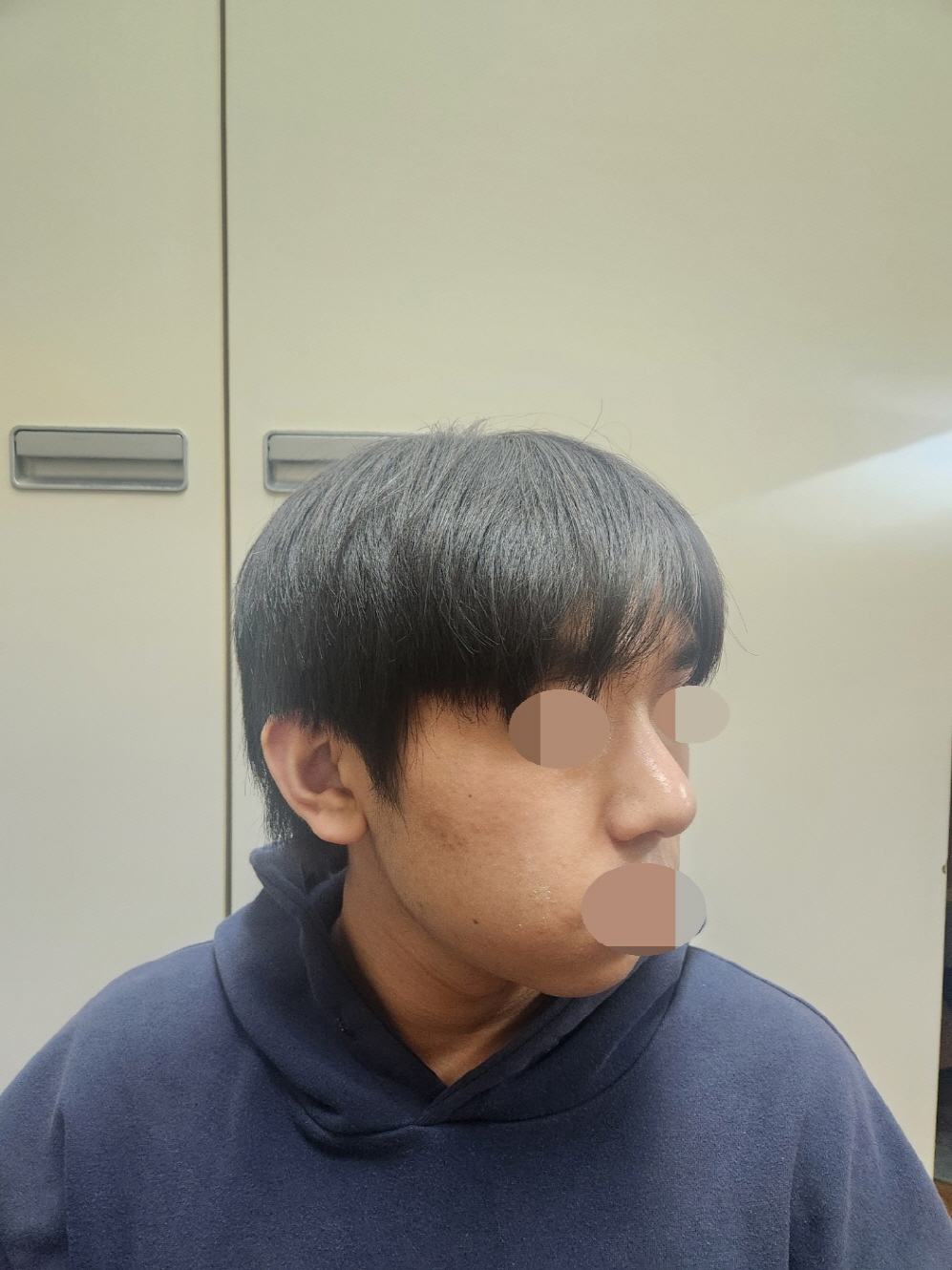 수술후기이미지