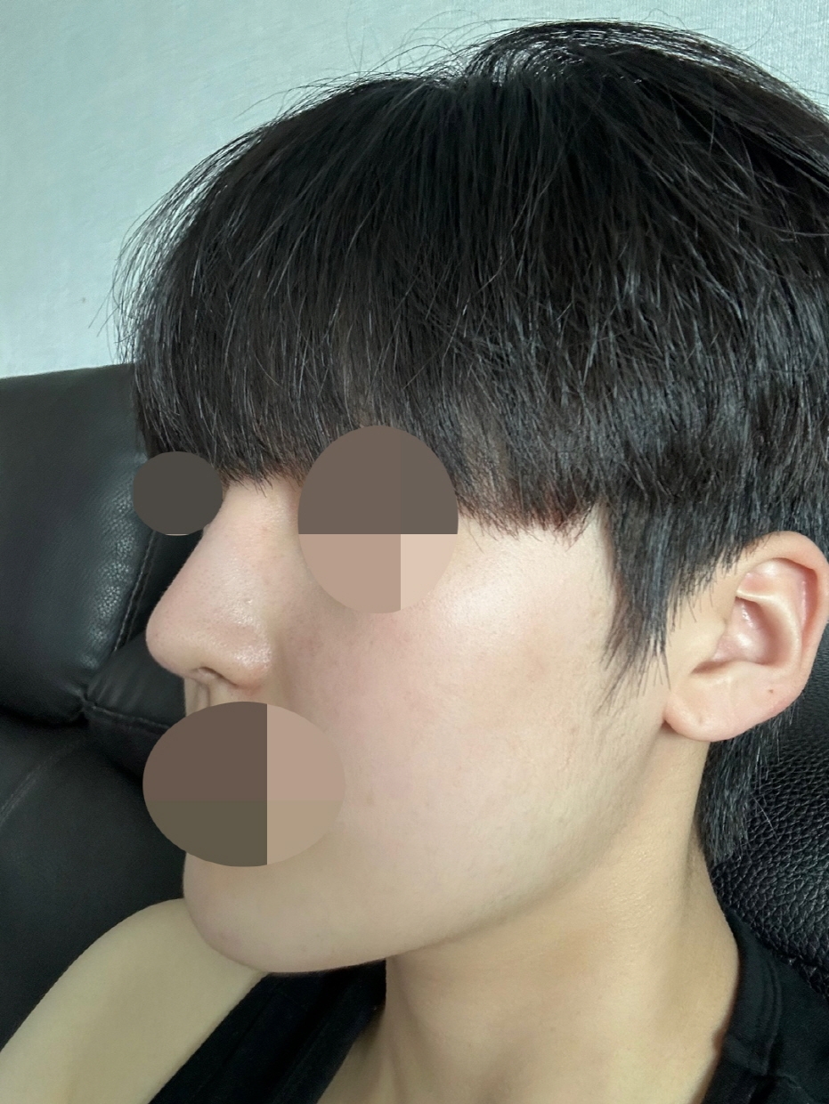 수술후기이미지