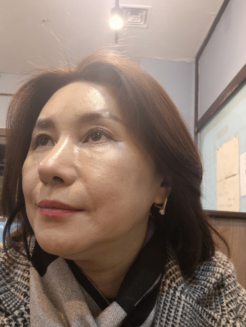 수술후기이미지