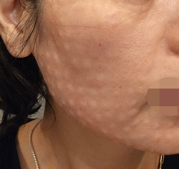 수술후기이미지