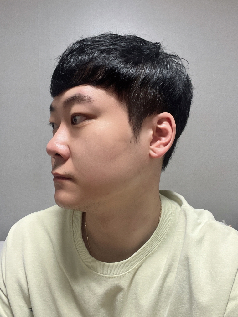 수술후기이미지