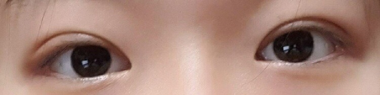 수술후기이미지