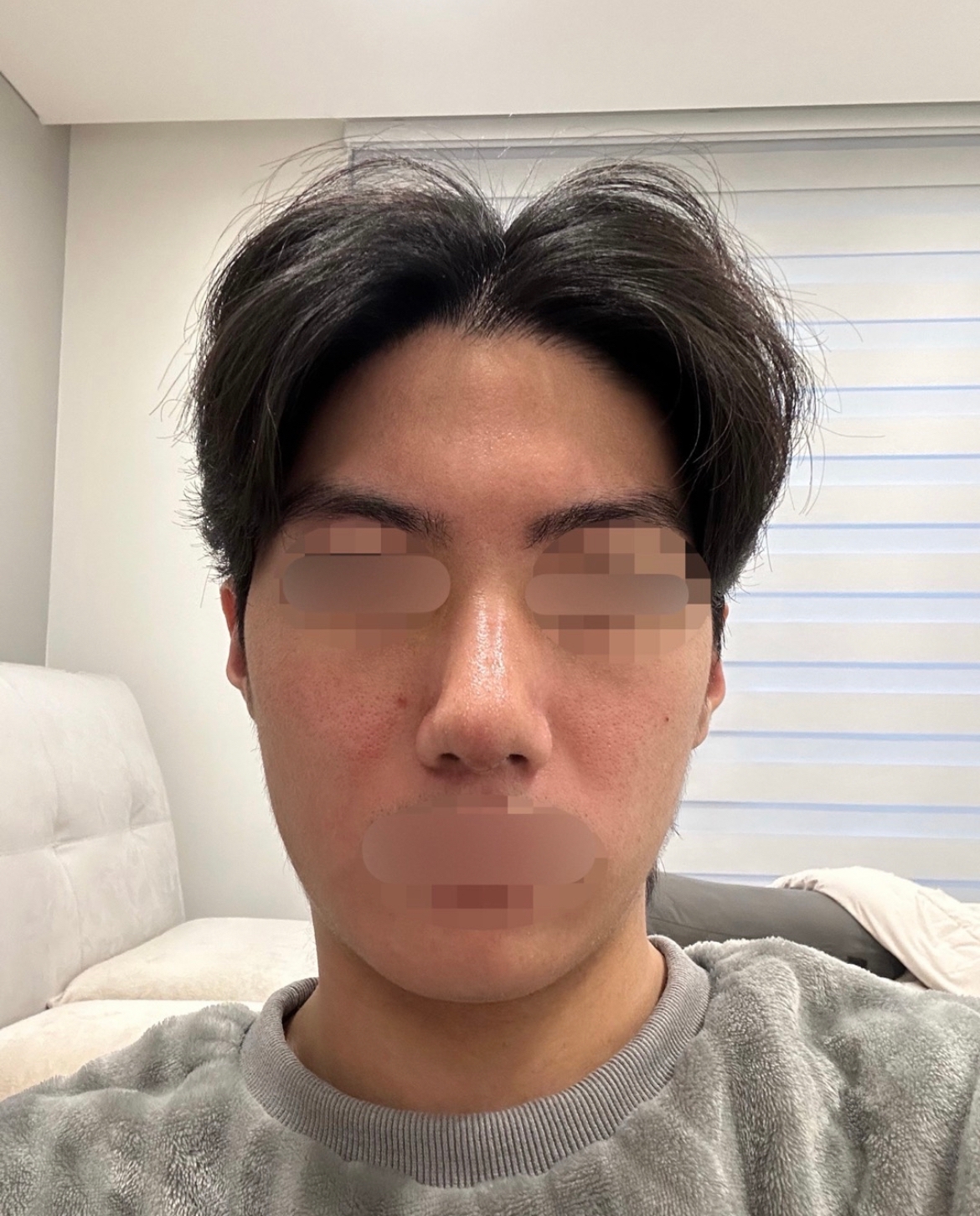 수술후기이미지