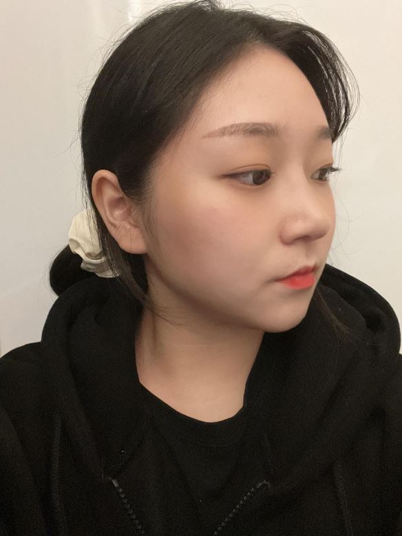 수술후기이미지