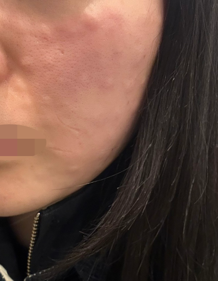 수술후기이미지